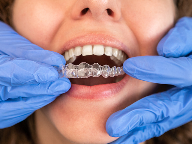 Invisalign Hillcrest Dental Care Pittsfield MA, Dentists Pittsfield MA, Dental In The Berkshires